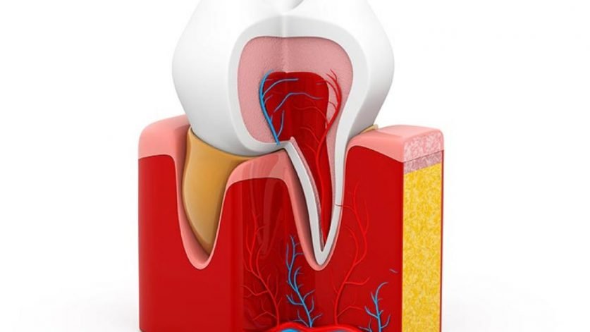 Root Canal Treatment