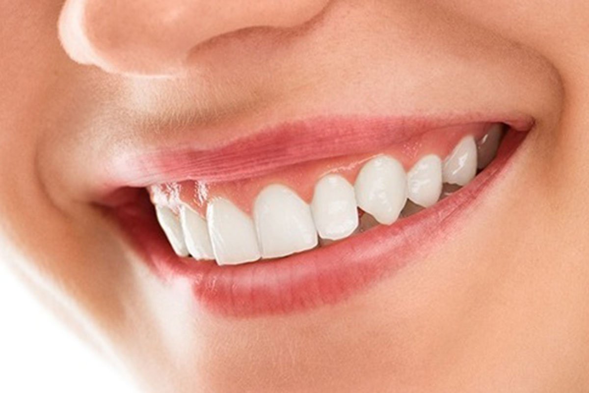 smile cosmetic dentistry