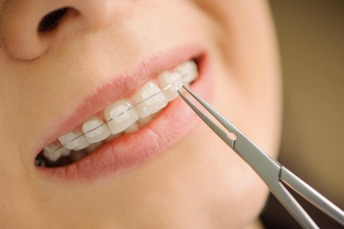 best orthodontist for braces in miami