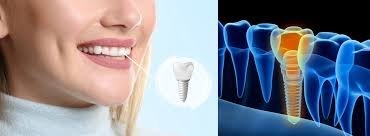 teeth whitening jaipur