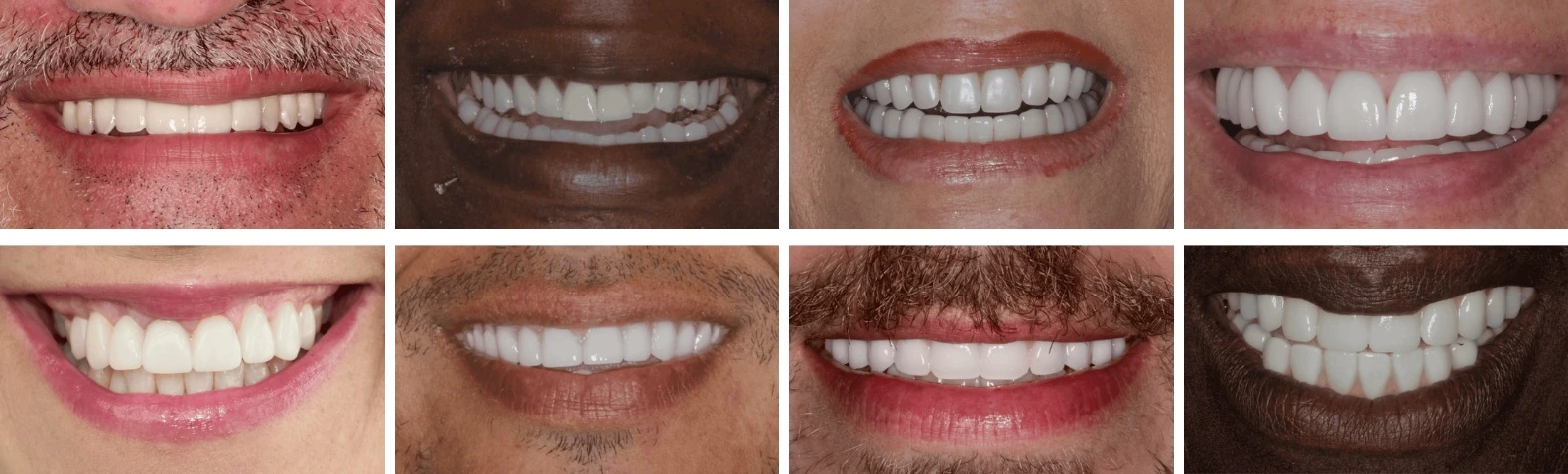 dental implants houston