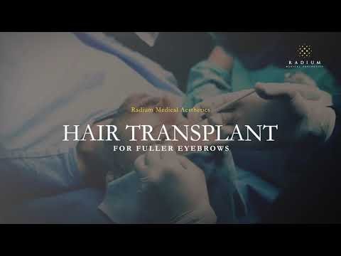 Fue Hair Transplant Singapore