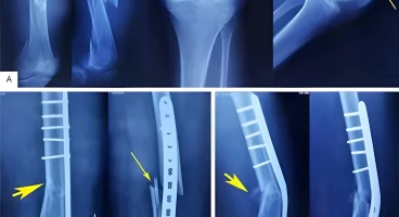 heal_image